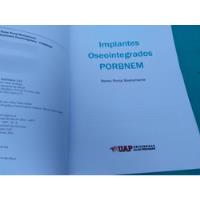 Mercurio Peruano: Libro Dental Implantes Integr Porbnem L118 segunda mano  Perú 